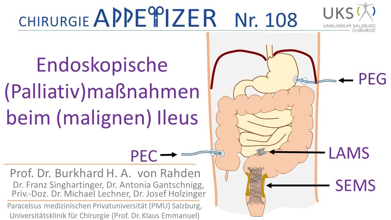 Endoskopische (Palliativ)massnahmen beim (malignen) Ileus CHIRurgie APPetizer Nr. 109