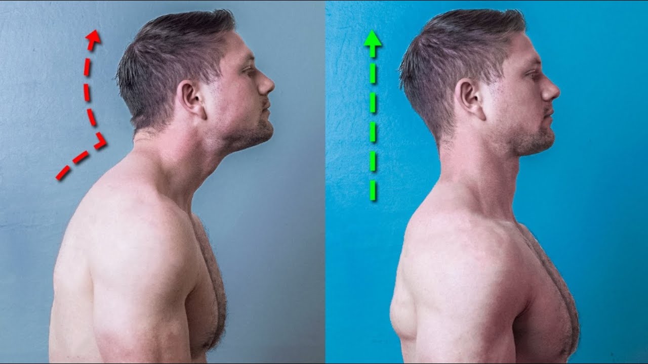 How to Actually FIX Forward Head Posture (The Science-Backed Way)