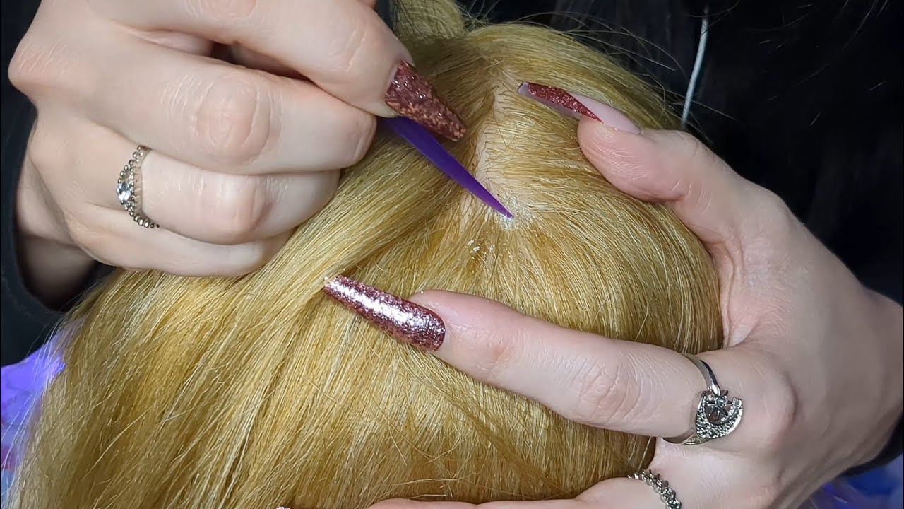 ASMR Scalp Check & Dandruff Search (No Talking)