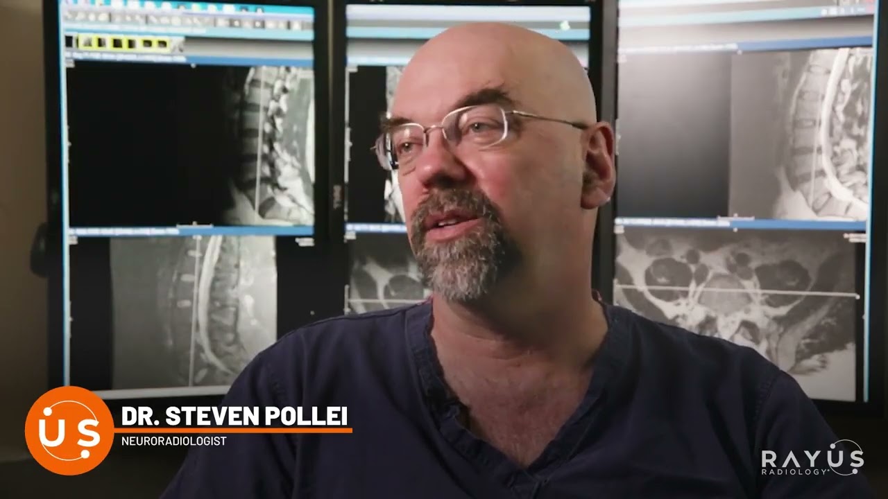 Back Pain: Before and After Steroid Injections