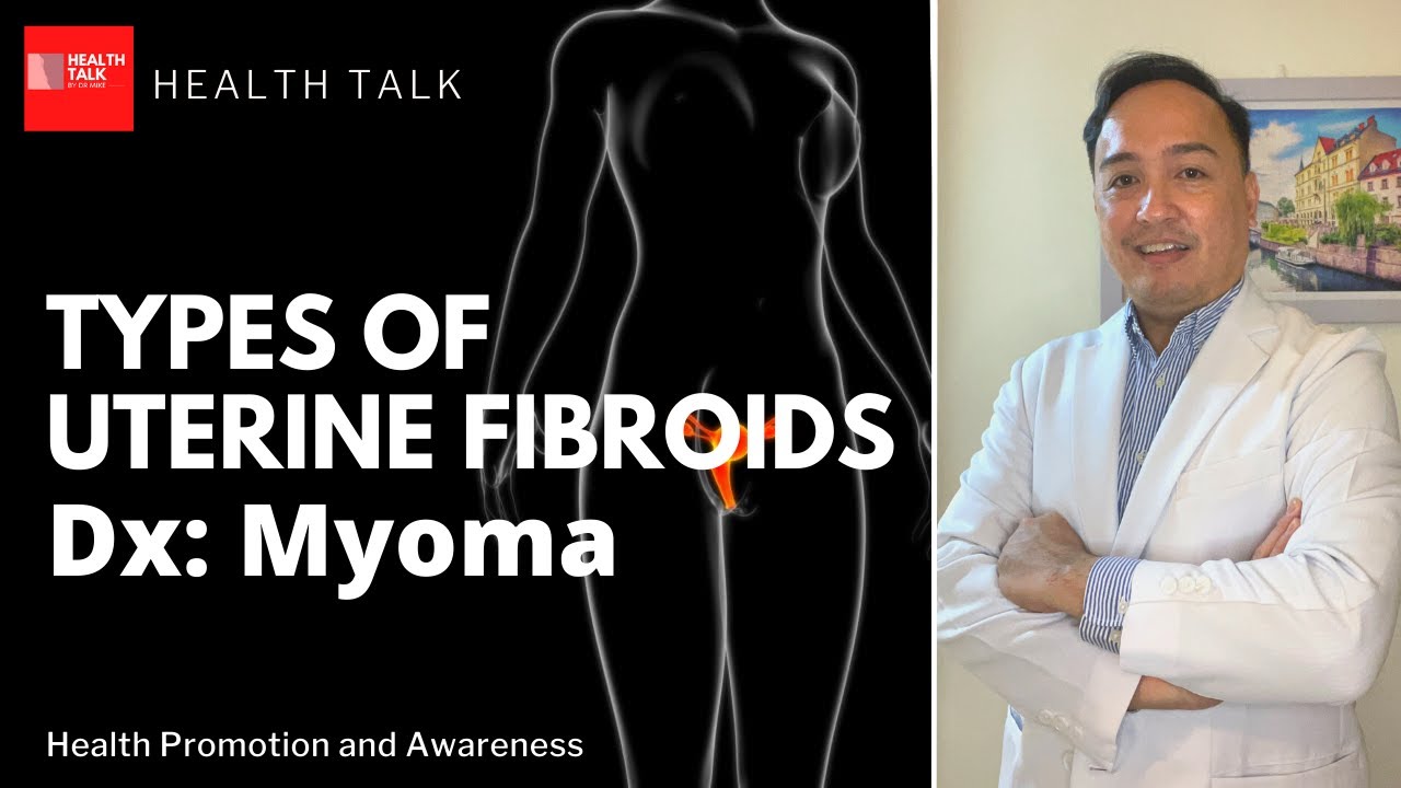 Different types of Uterine Fibroids: Types, Symptoms and Diagnosis