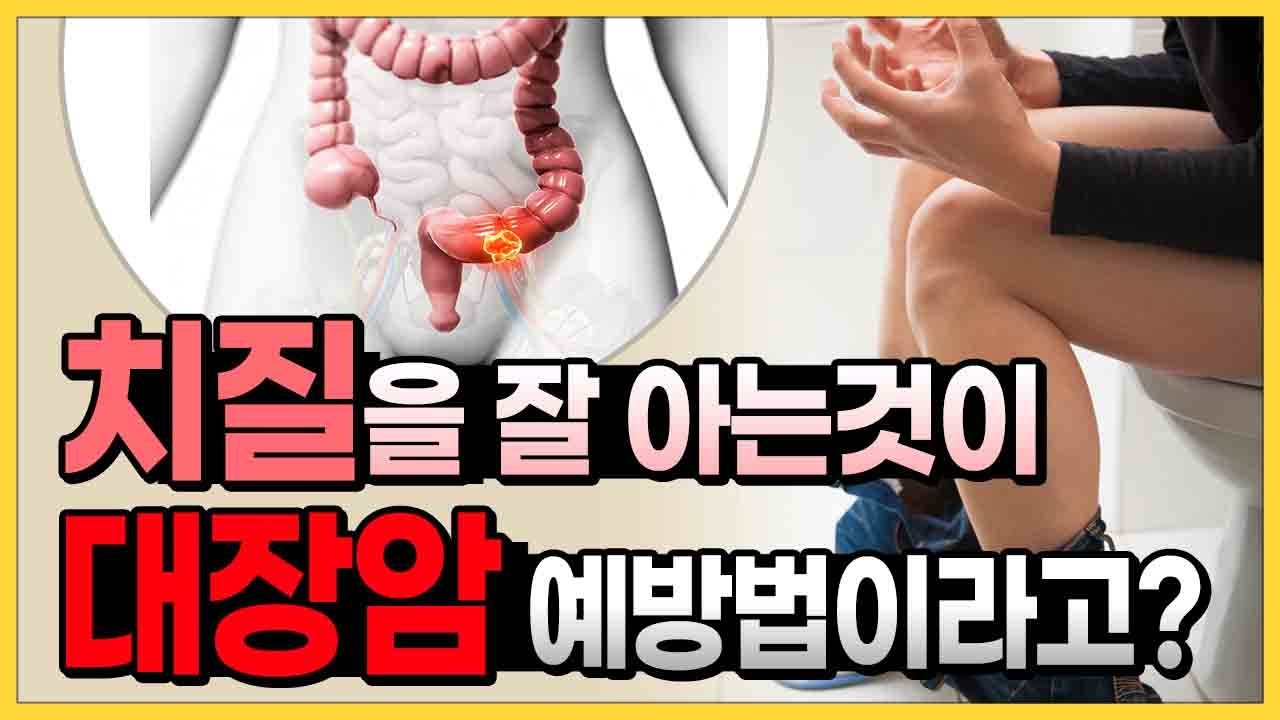 대장암 예방법은 치질부터 잘 알아야 한다? 강동구 치질수술, 강동구 치질병원, 거상치질수술