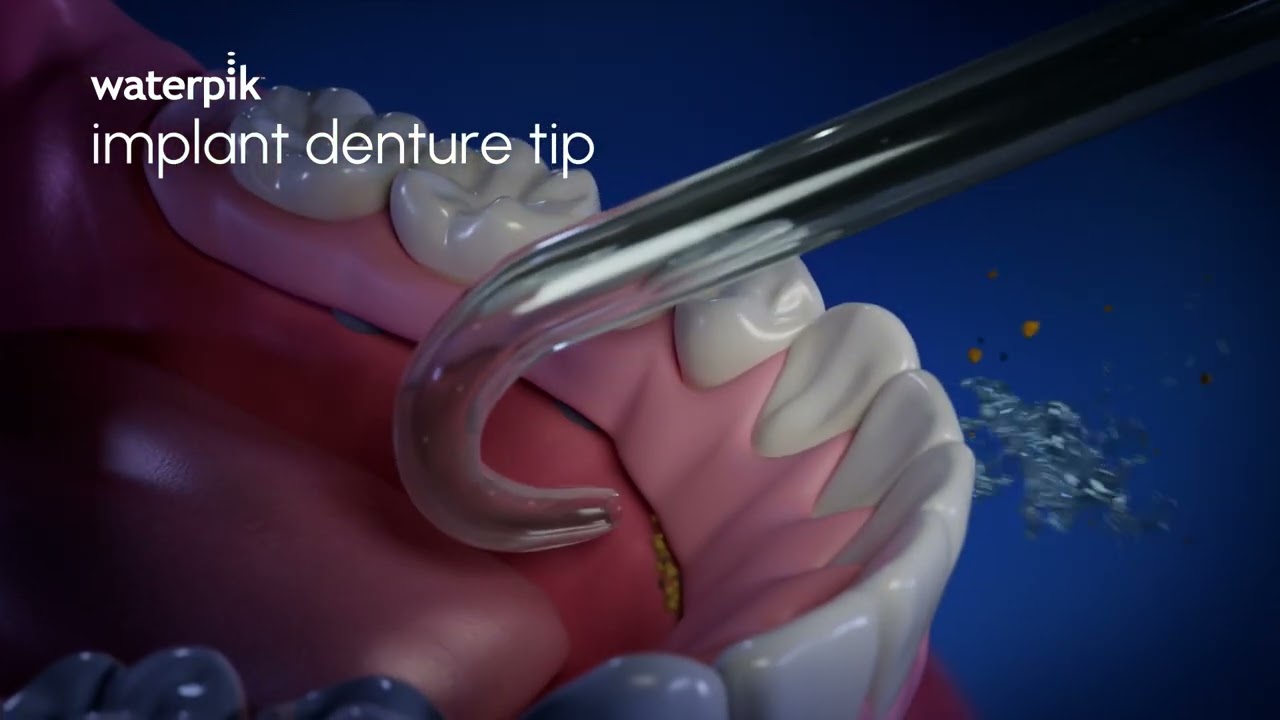 Waterpik&trade; Implant Denture Tip