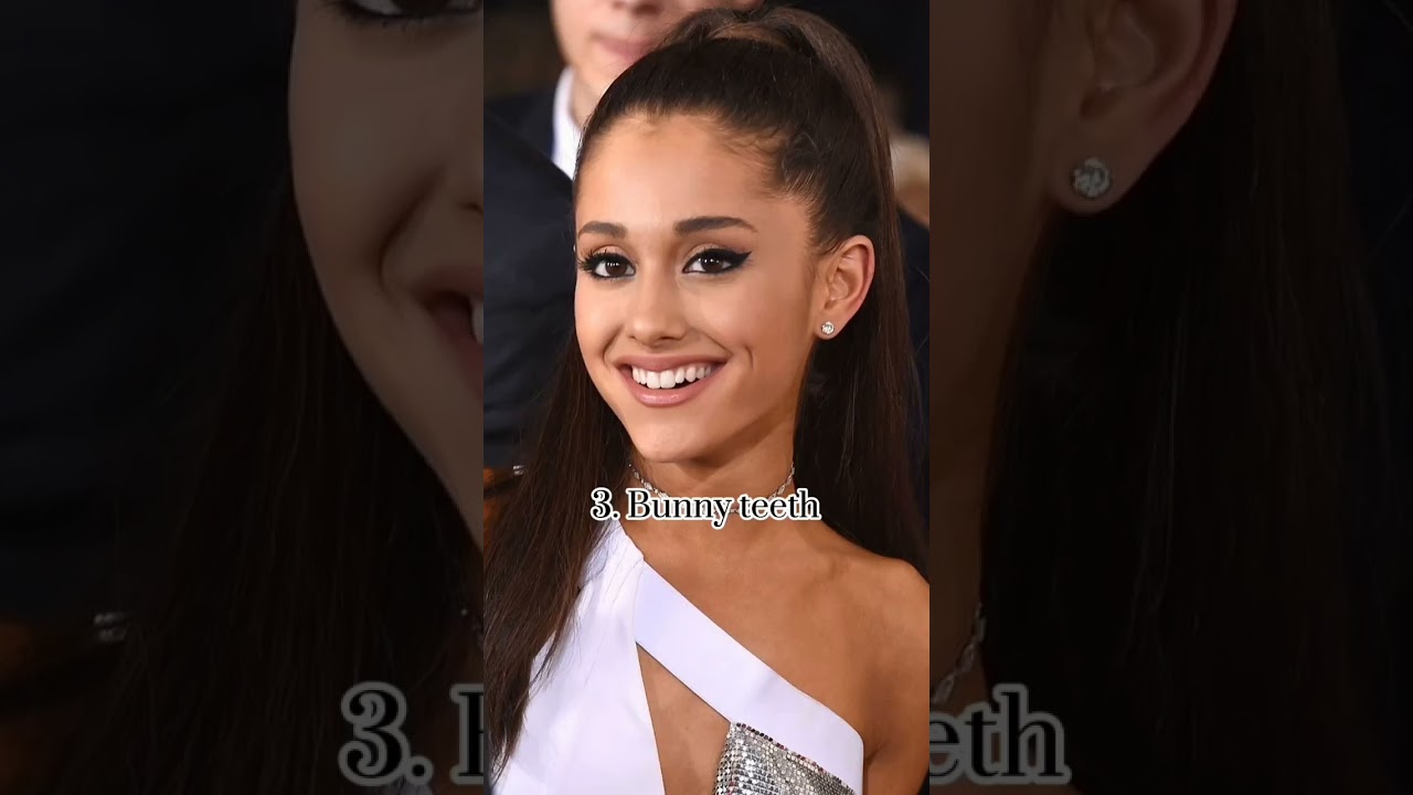 ✨Types of teeth ✨#aesthetic #fypシ #beauty