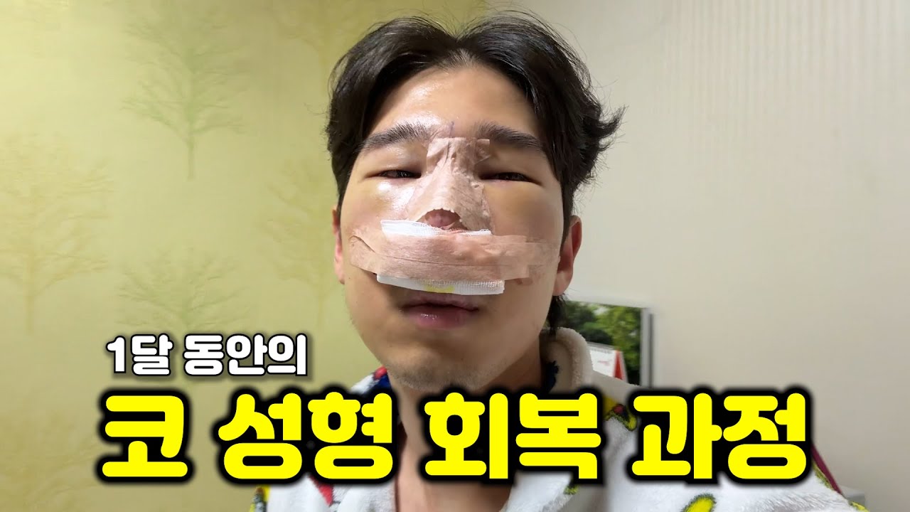 코성형 한다면 반드시 봐야하는 영상