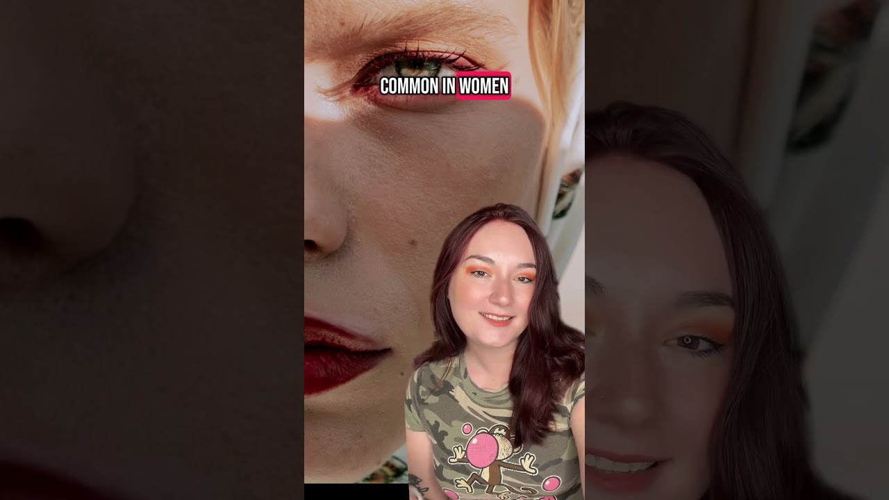 Facts about green eyes! 💚👀 