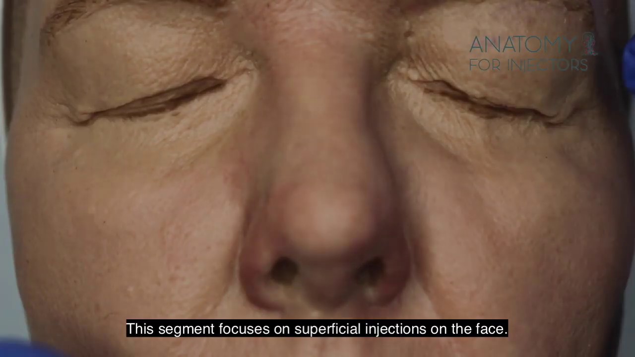 Different depth of injection - Intradermal, Subdermal and subcutaneous.