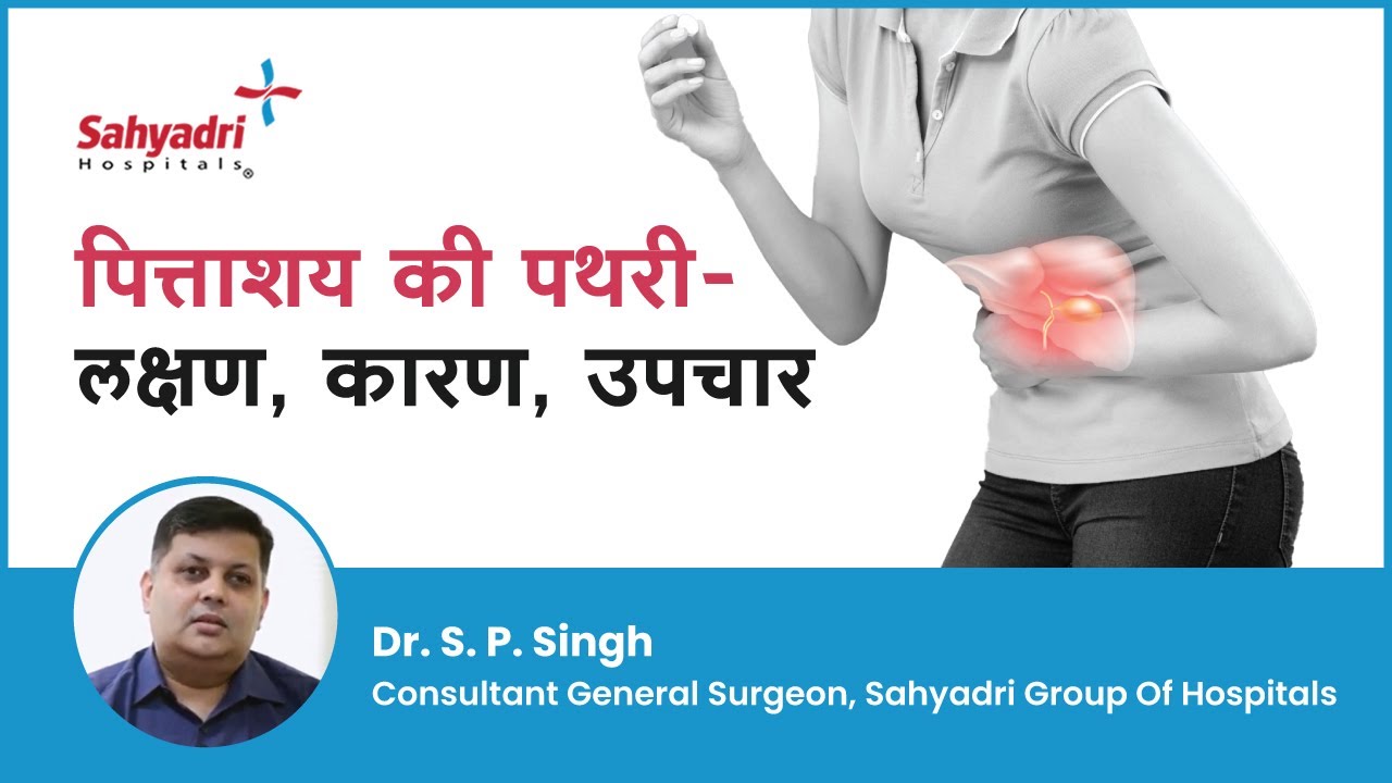 पित्ताशय की पथरी - लक्षण, कारण और उपचार  | Gallbladder stone in Hindi | Dr. S. P. Singh | Sahyadri