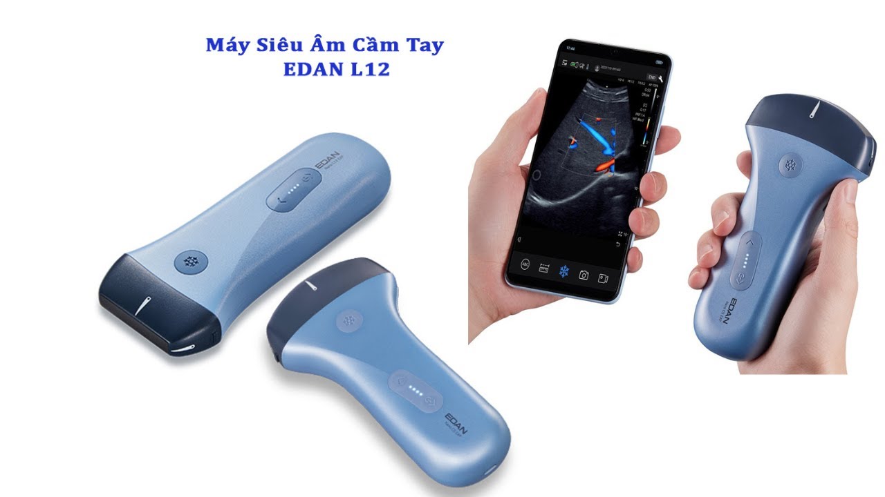 Máy Siêu Âm Mini Cầm Tay EDAN || Giới Thiệu Và Trải Nghiệm
