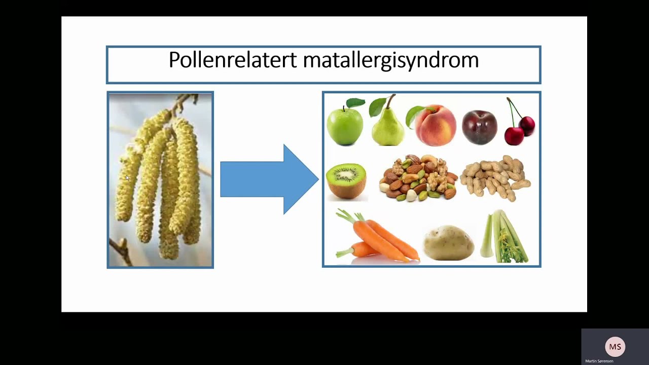 Webinar om pollenallergi - Norges Astma- og Allergiforbund