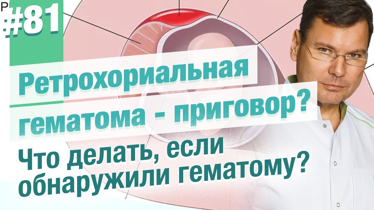 Ретрохориальная гематома на 8 неделе: Можно ли сохранить беременность?