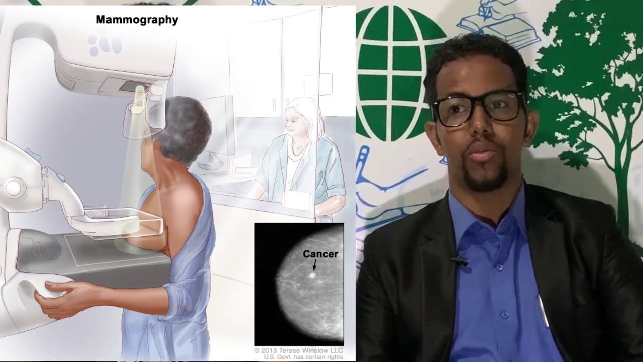 KANSARKA NAASAHA(breast cancer) afsomali