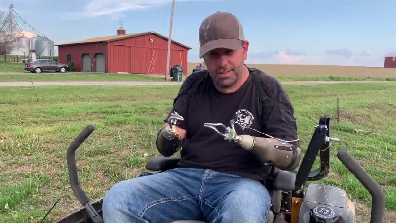 Wrist Rotators - Tips for Using a Riding Lawn Mower with Upper Limb Prosthetics