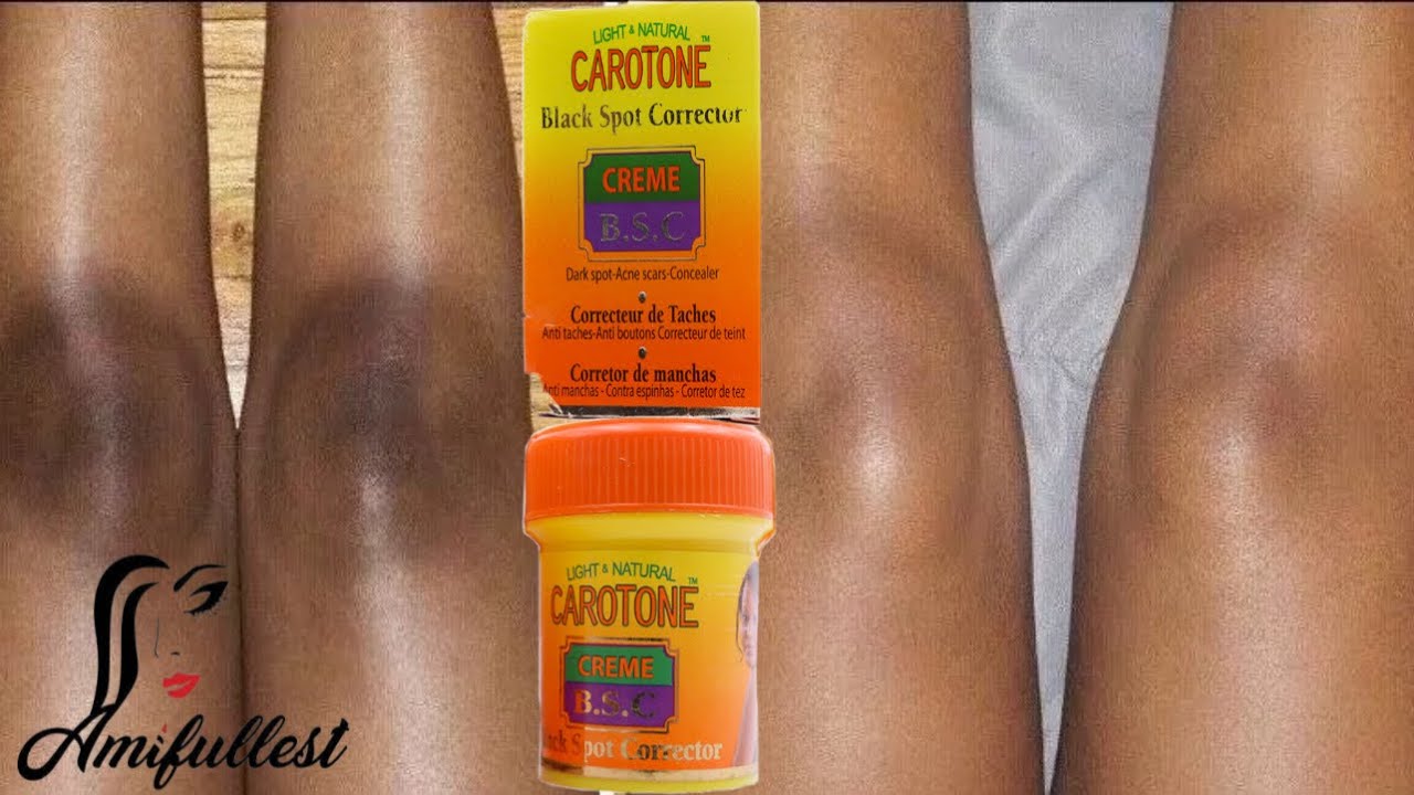 CAROTONE B.S.C | carotone cream black spot corrector | how to lighten your knee and your elbow