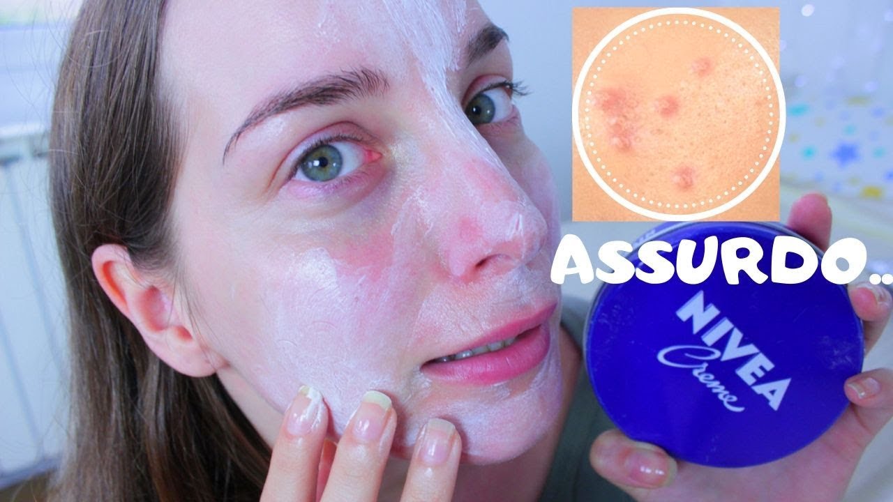 Ho usato la famigerata NIVEA CREME sulla mia pelle per una settimana