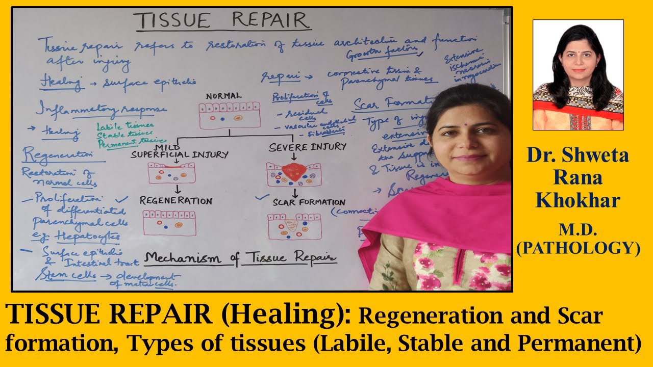 TISSUE REPAIR (Healing): Regeneration & Scar formation | Labile, Stable and Permanent Tissues |