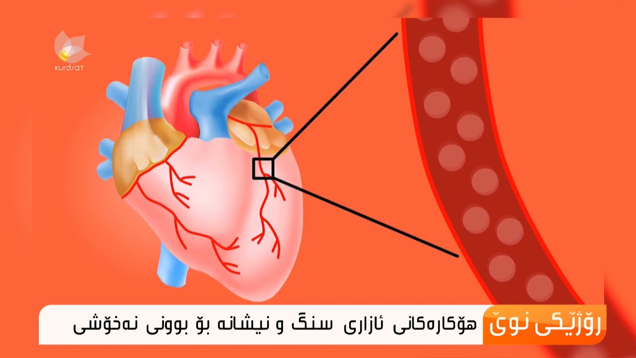 هۆكار و نیشانەكانی ئازاری سنگ ..سوارە عەلی