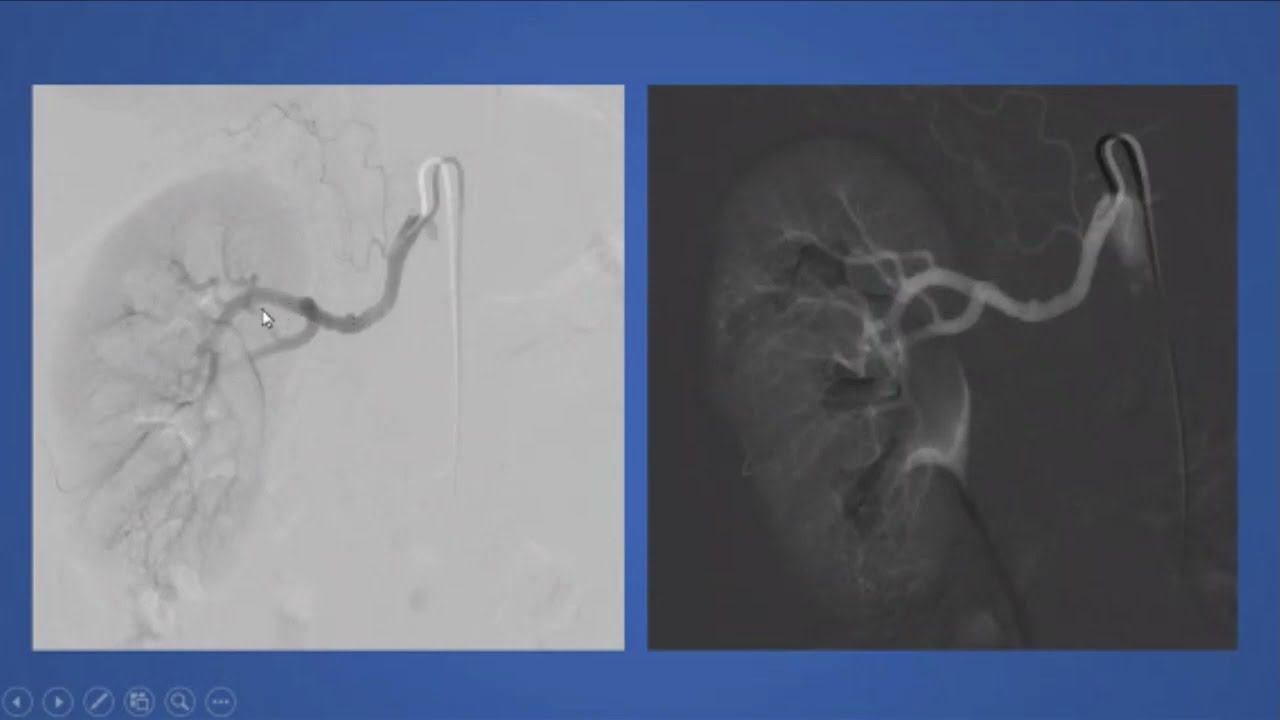 Case Review of Vascular and Interventional Radiology - Course Sample