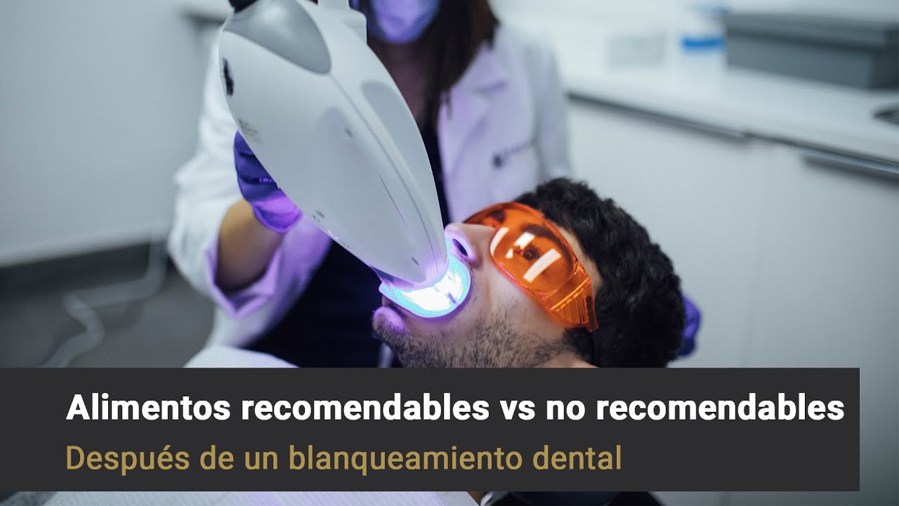 Provenza Clínica Dental - Alimentos recomendables después de un Blanqueamiento dental