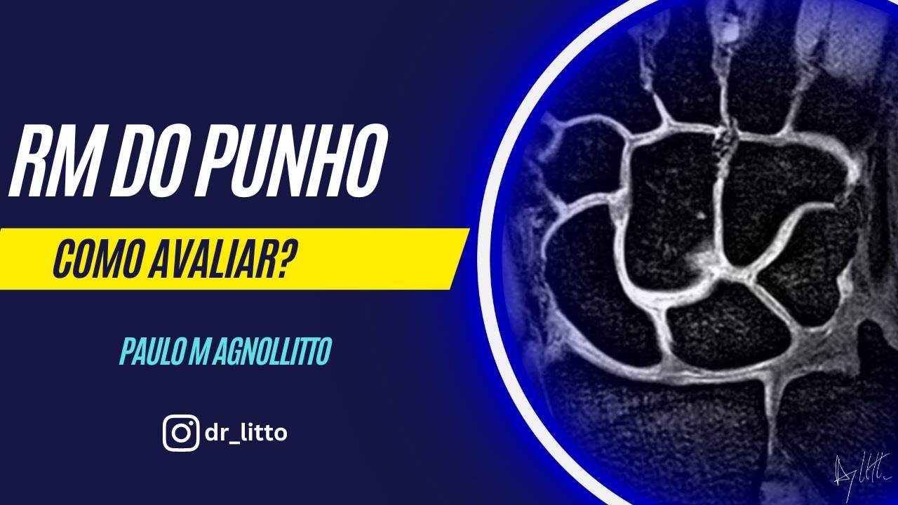 RM DO PUNHO: COMO AVALIAR?