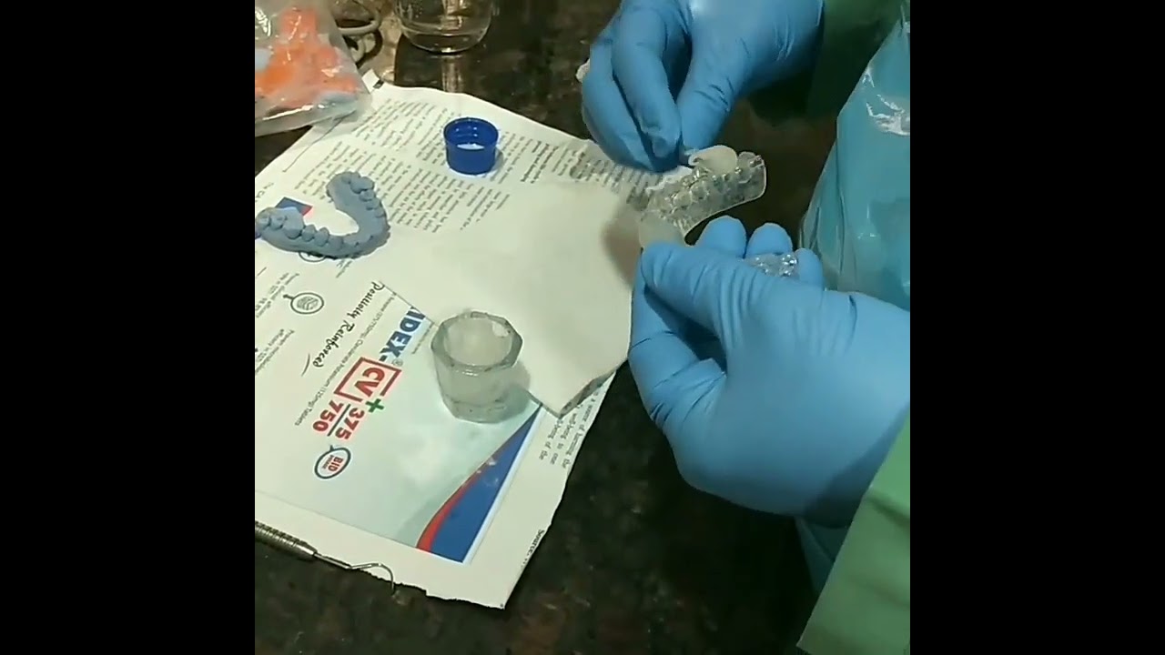 The Making Of A TMJ Splint.