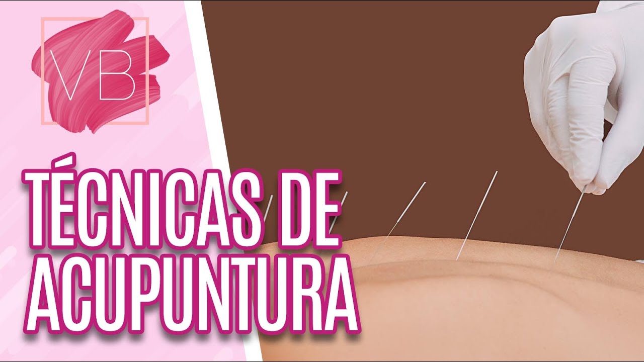 Entenda melhor as técnicas de acupuntura - Você Bonita (20/08/20)