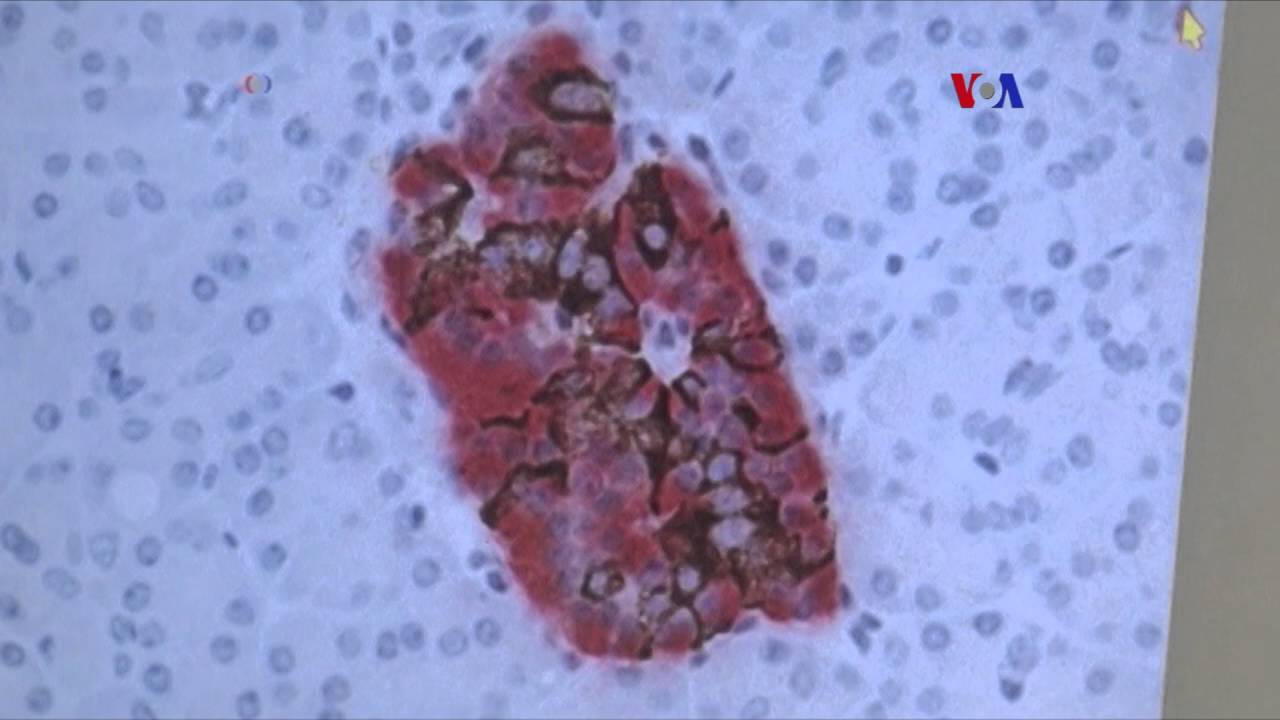 Nanotecnología para diabetes