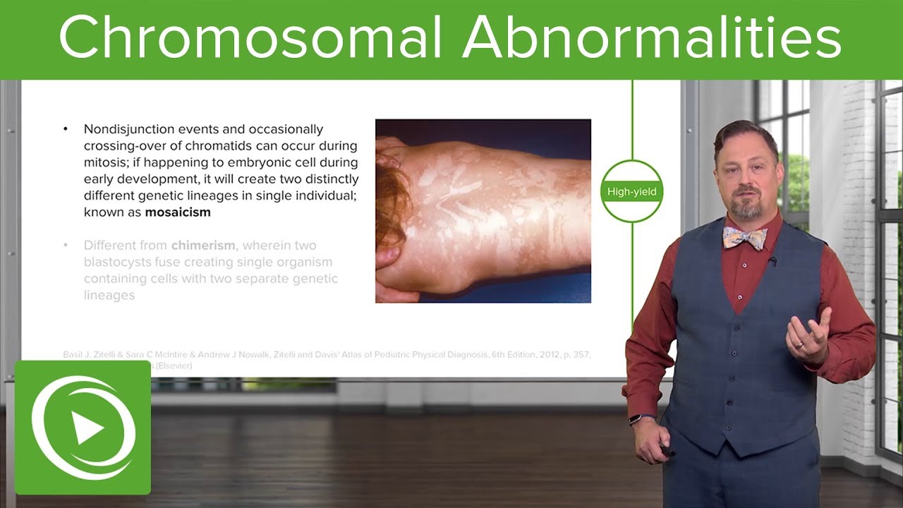 Chromosomal Abnormalities: Turner, Klinefelter & Rett Syndrome, Trisomy etc. – Embryology | Lecturio