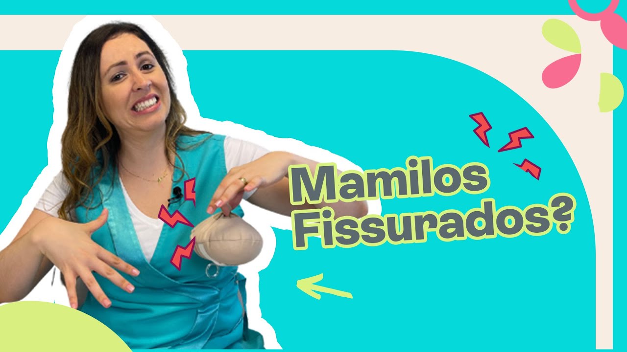 FISSURA MAMILAR 5 Dicas Para Voc&ecirc; que Sofre com Mamilo Rachado - Home Baby Assessoria