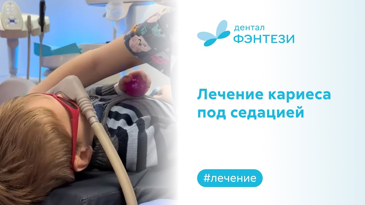 💁 🦷  Лечение кариеса под седацией