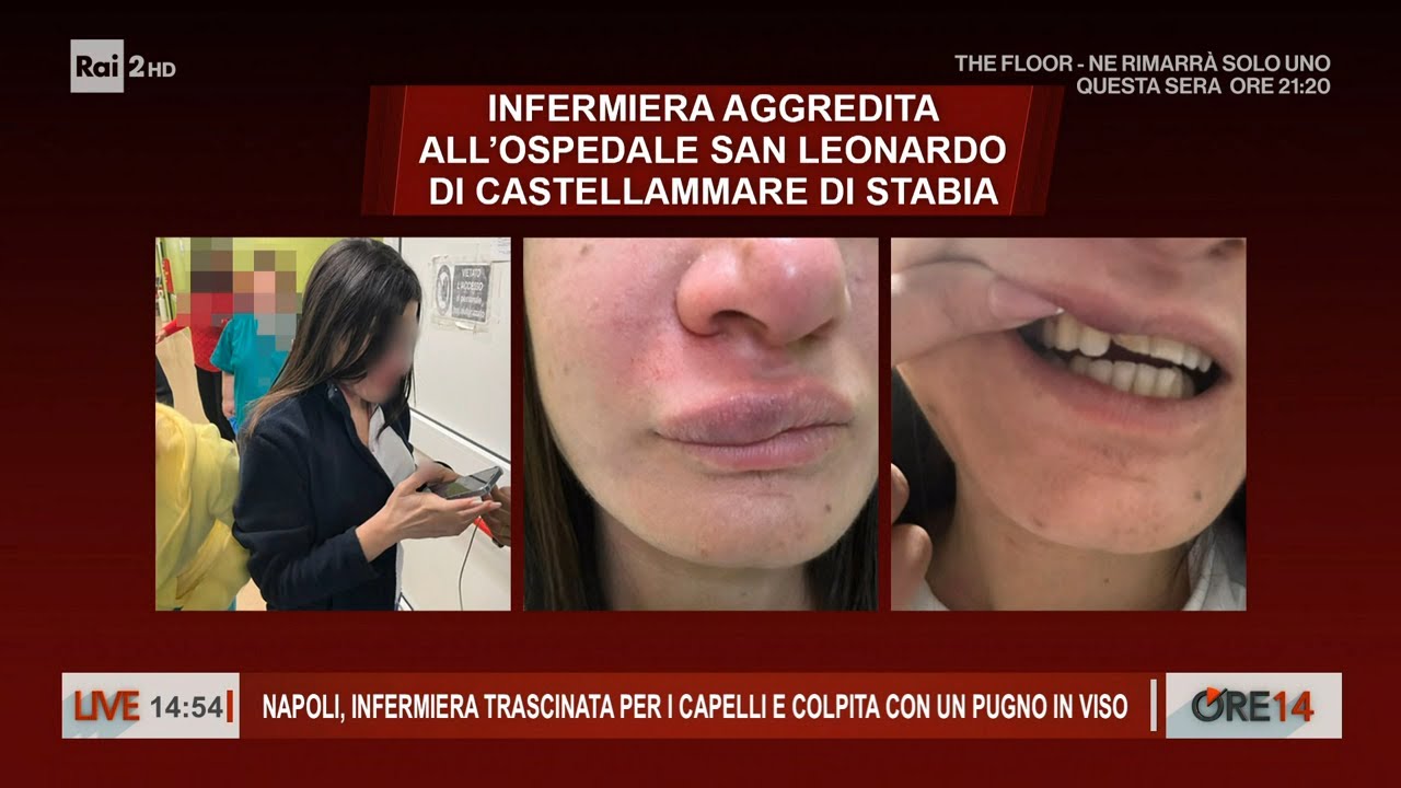 Napoli, infermiera trascinata per i capelli e colpita in viso - Ore 14 del 04/01/2024