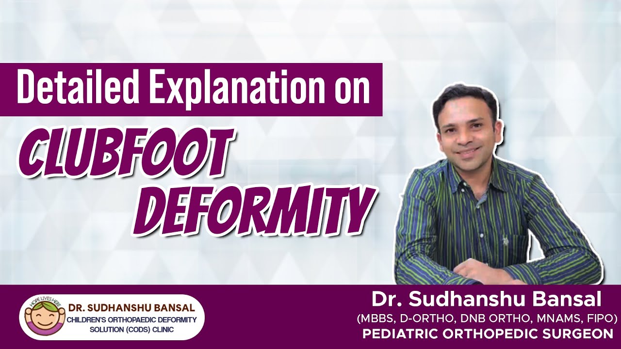 Know About Clubfoot | Dr. Sudhanshu Bansal | Paediatric Orthopaedic Surgeon in Punjab