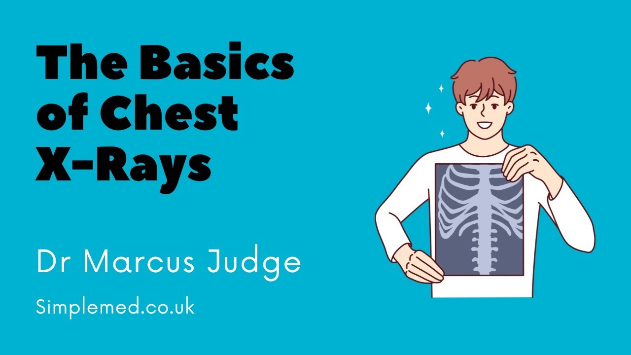 The Basics of Chest X-Rays | SimpleMed Radiology Lecture Series | Dr Judge