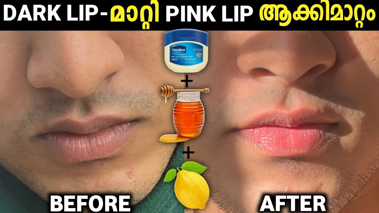 Increase Lip Colour | Reduce Pigmentation (Lip care for Men)
