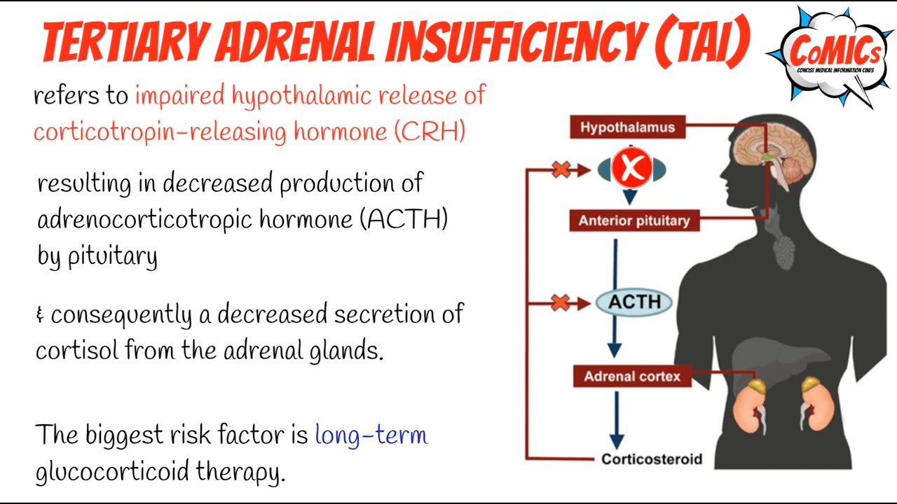 CoMICs Episode 76: Tertiary Adrenal Insufficiency