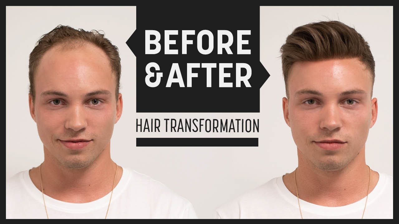Johnny Edlind High Volume Hairstyle 2018 | Transformation mit Haarsystem | Hairsystems Heydecke