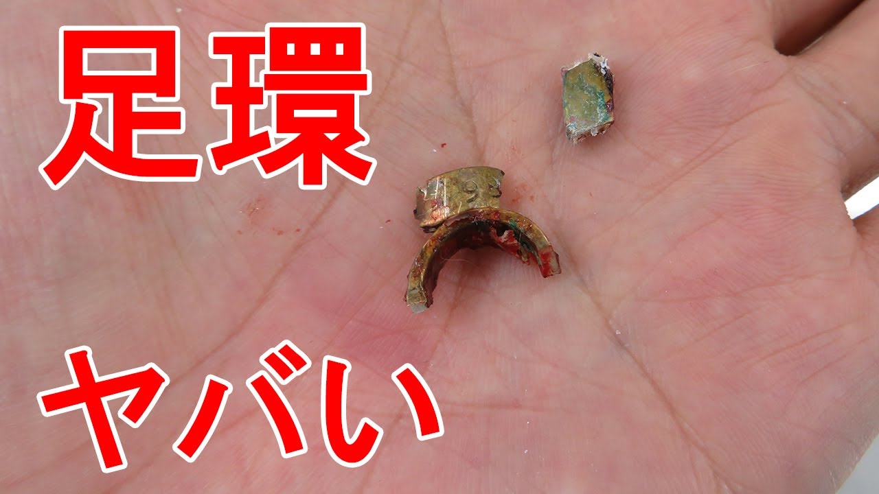 【鳥】獣医師が教える足環の秘密と事故について