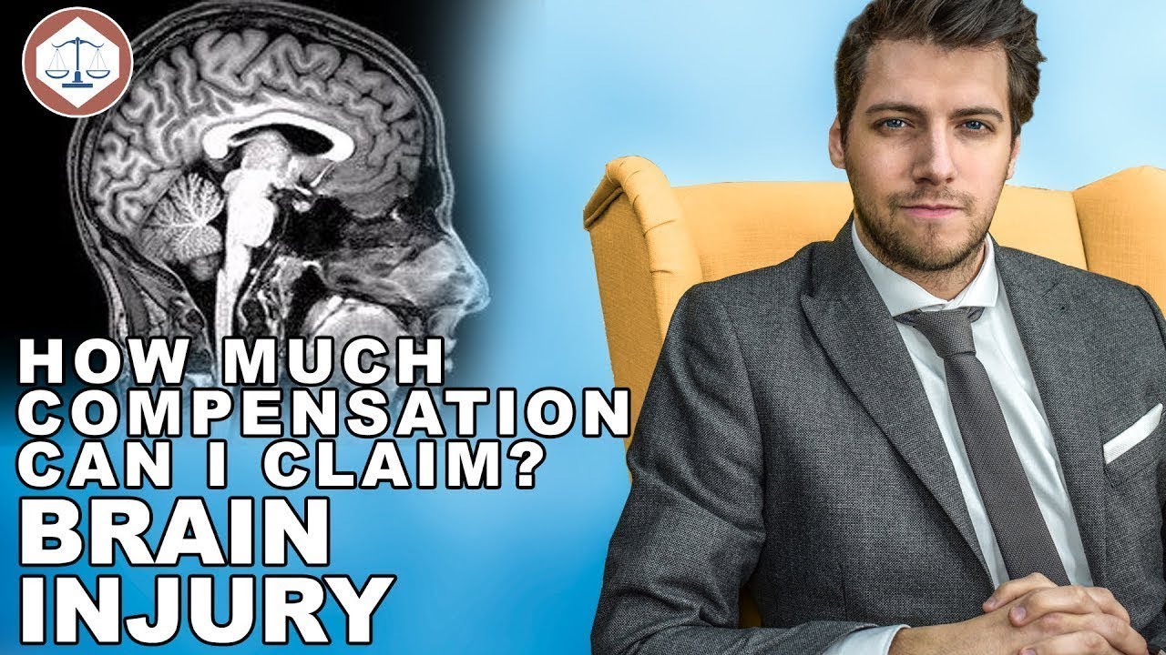 Brain Damage Compensation Claims Amounts? ( 2019 ) UK