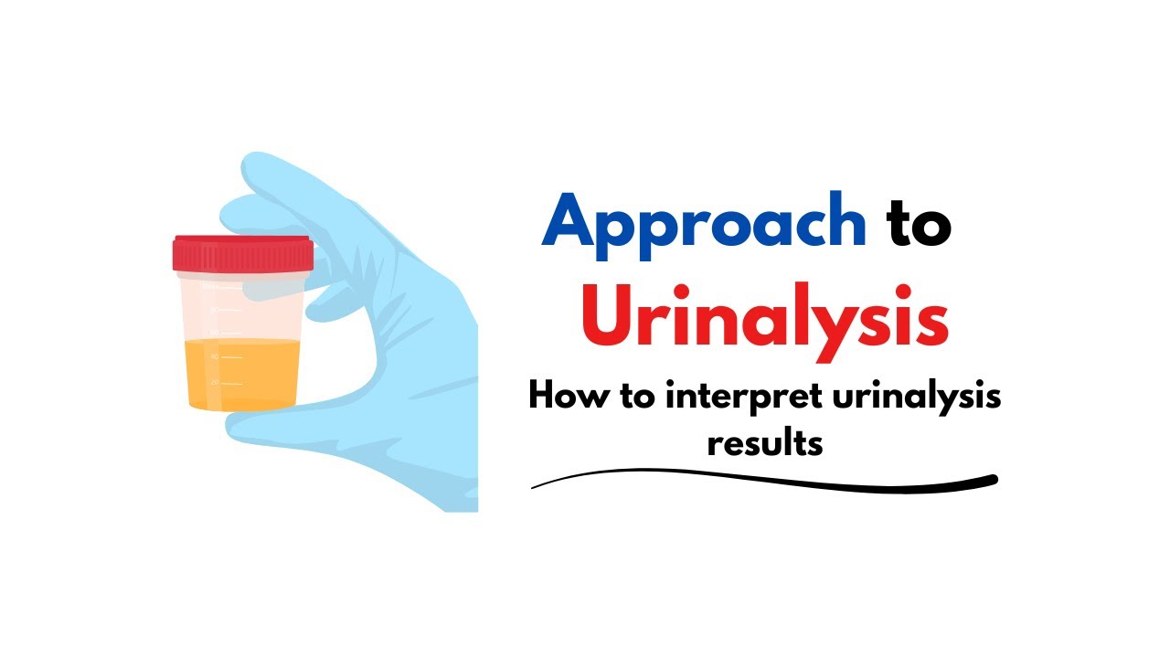 How To Interpret Urinalysis Results? #usmle #medschool #medicine