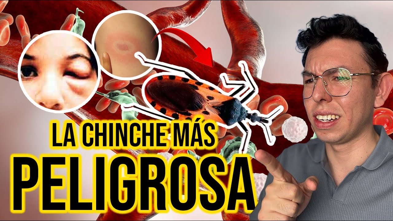 Si VES esta CHINCHE , CORRE! (Enf de Chagas)| DrPoloGuerrero