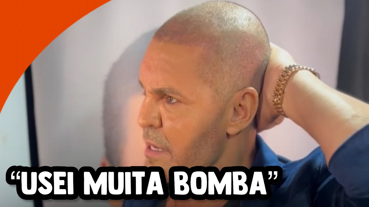 EDUARDO COSTA REVELA POR QUE FICOU CARECA