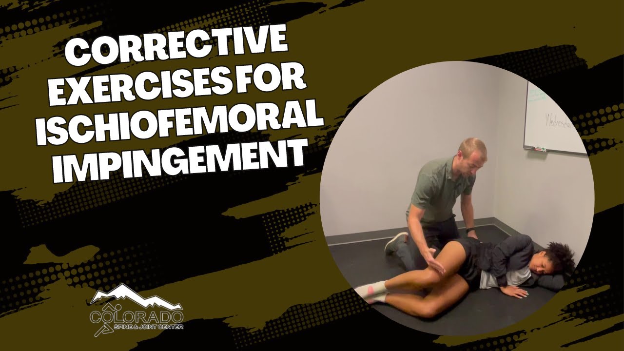 Corrective Exercises for Ischiofemoral Impingement  / Thornton, Colorado Chiropractor