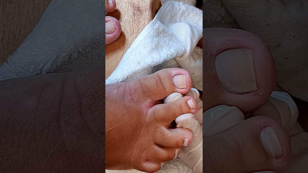 Francesinha em unhas curta .
