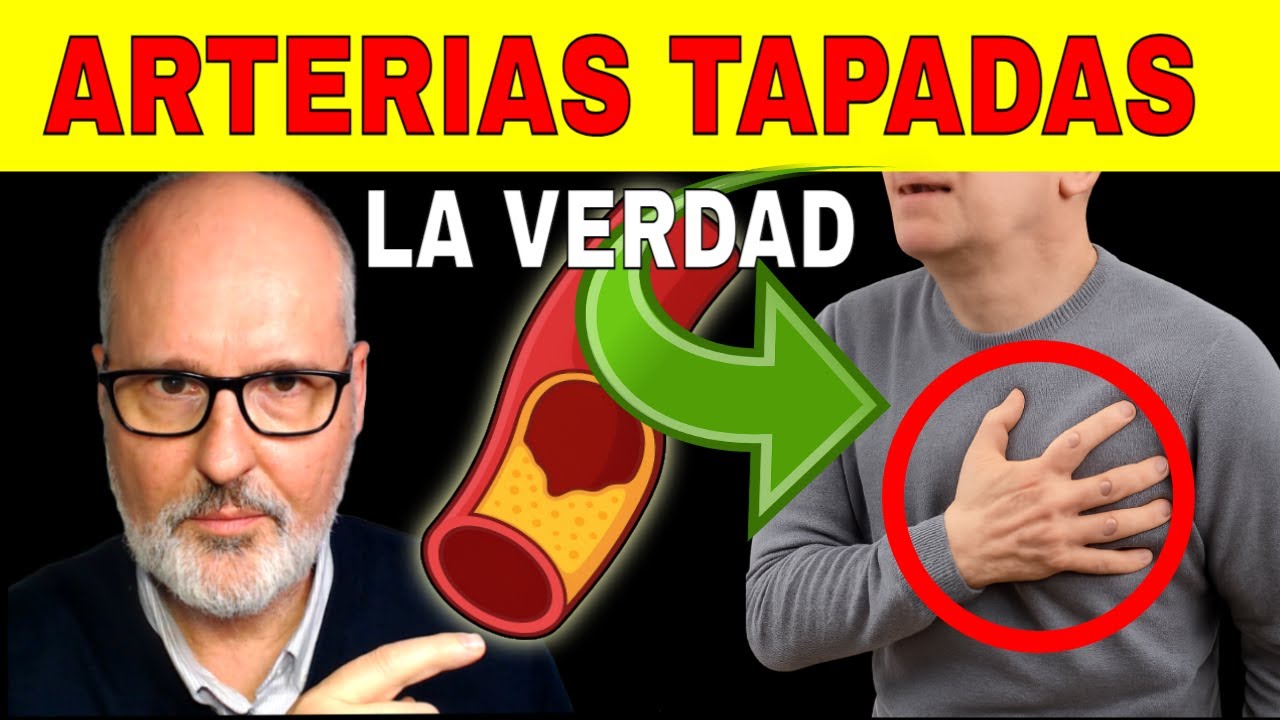 ARTERIAS BLOQUEADAS: Síntomas Alarmantes, Mitos Peligrosos (Cómo Saber si Tienes Riesgo)
