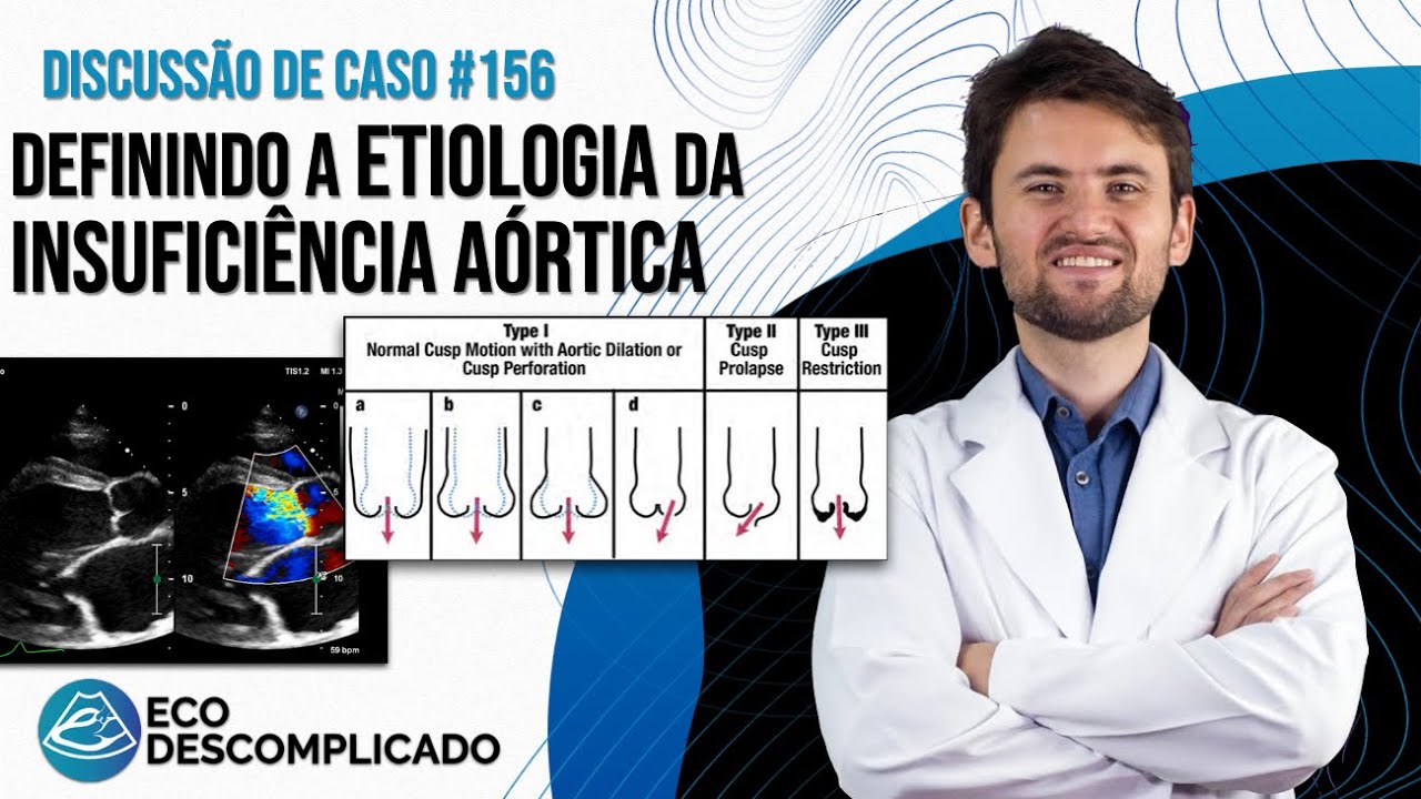 Необычная (?) причина аортальной недостаточности | Обсуждение клинического случая EcoDescomplicad...