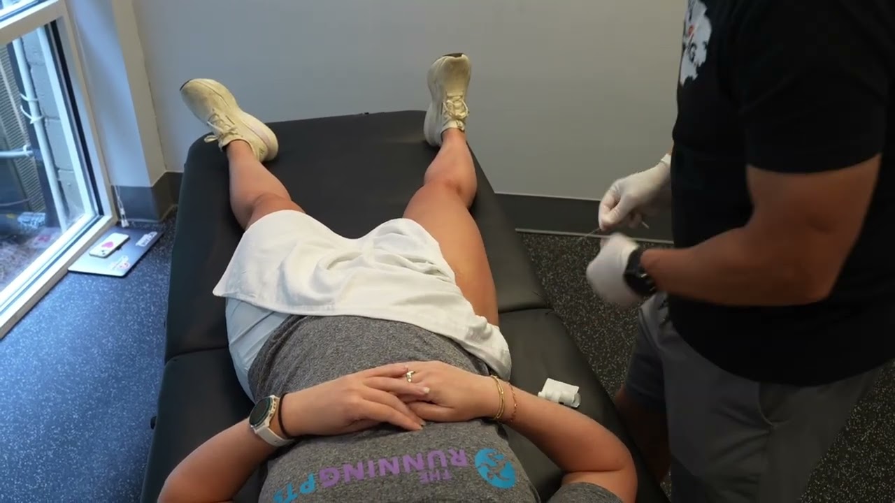 Dry Needling Tight Quads & TFL: Faster Recovery for Runners