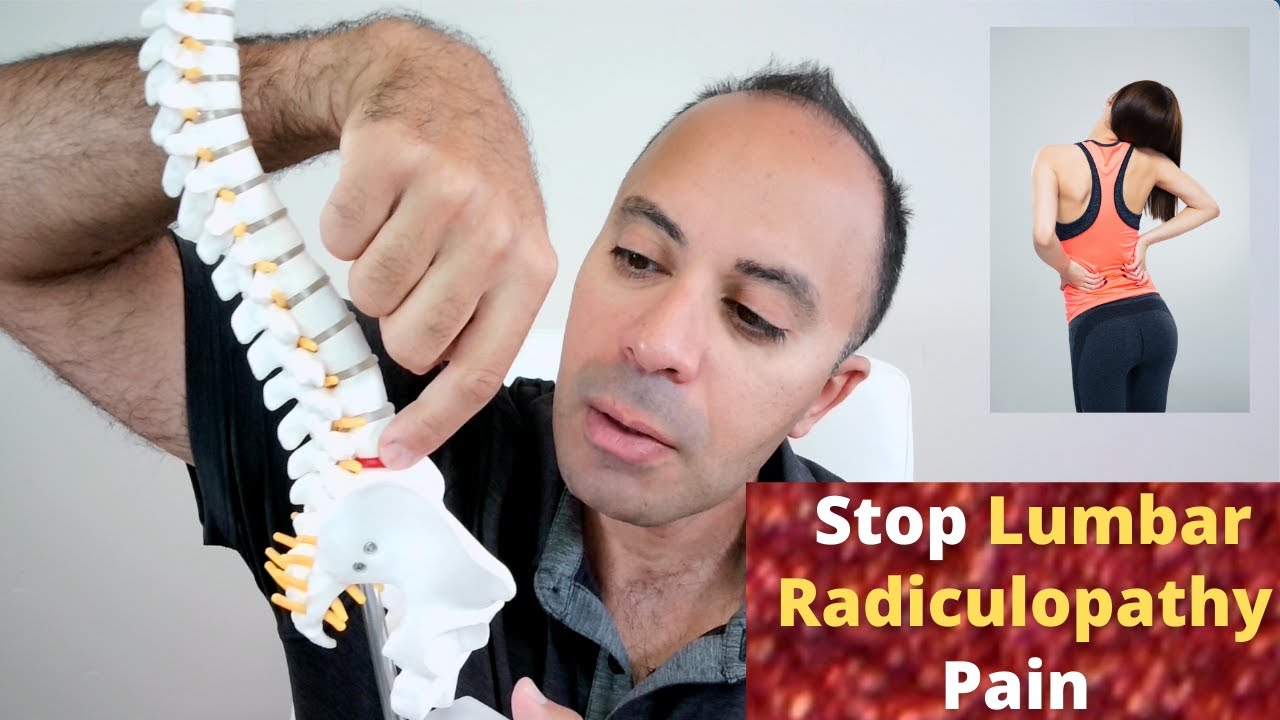 End Lumbar Radiculopathy Naturally: Symptoms, Causes, Risk Factors, Healing Cycle & Treatment