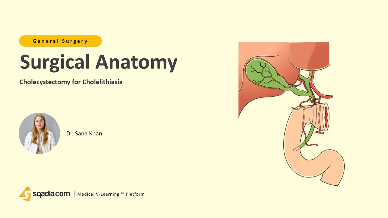 Cholecystectomy for Cholelithiasis | Surgery Lecture | Surgical Anatomy