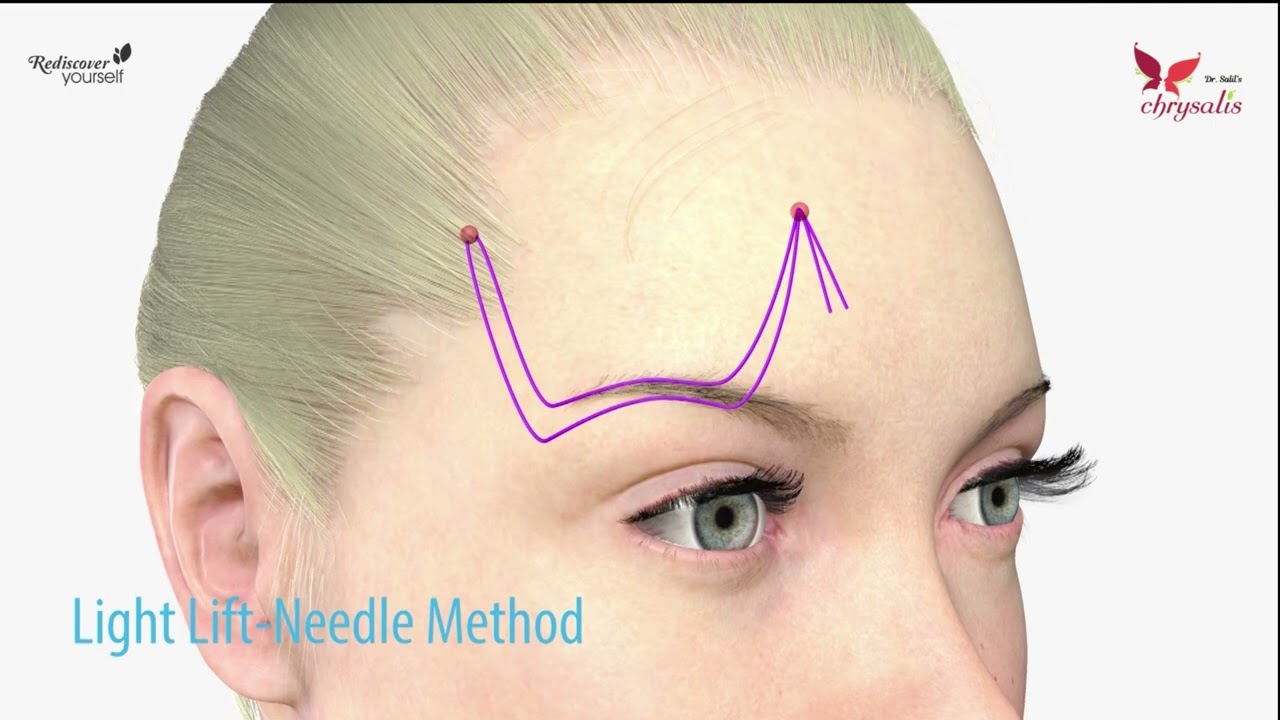 Latest technology Aptos Thread lift - Now in Pune