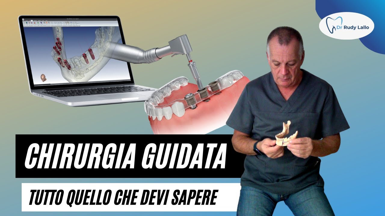Implantologia Computer Guidata: Tutto quello che devi sapere.
